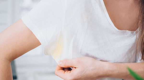 Golden Pits: Why White Shirts Turn Yellow, Plus How To Remove Pit Stains